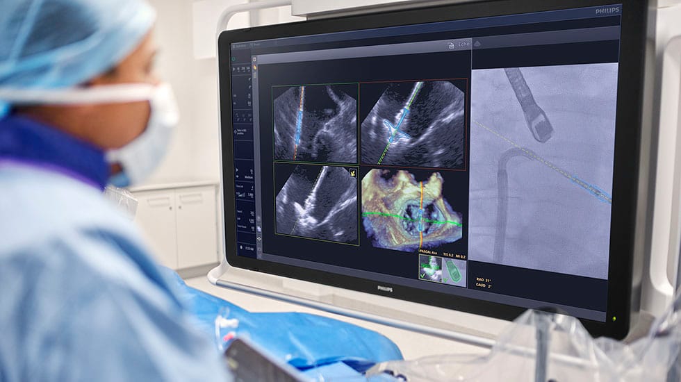 Physician using DeviceGuide with EchoNavigator 5